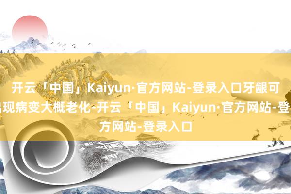 开云「中国」Kaiyun·官方网站-登录入口牙龈可能会出现病变大概老化-开云「中国」Kaiyun·官方网站-登录入口